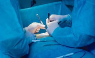 Ligamentotoomia - operatsioon peenise pikkuse suurendamiseks